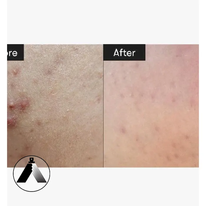 سرم ریدل شات ملایم VT Cosmetics